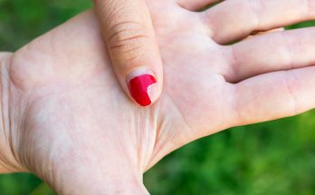 Ongles cassants : Découvrez les causes de la fragilité